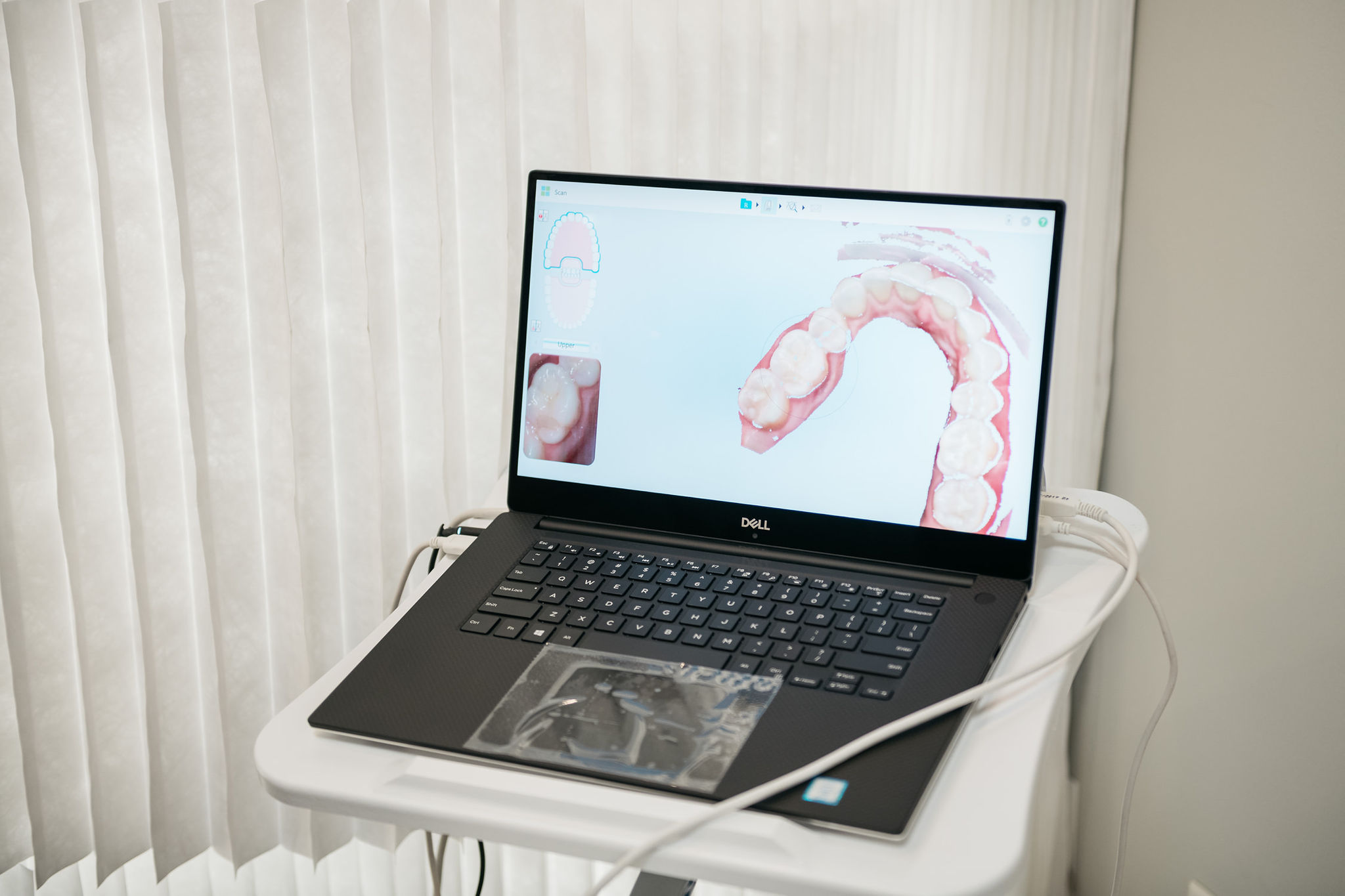 clear aligners with candid