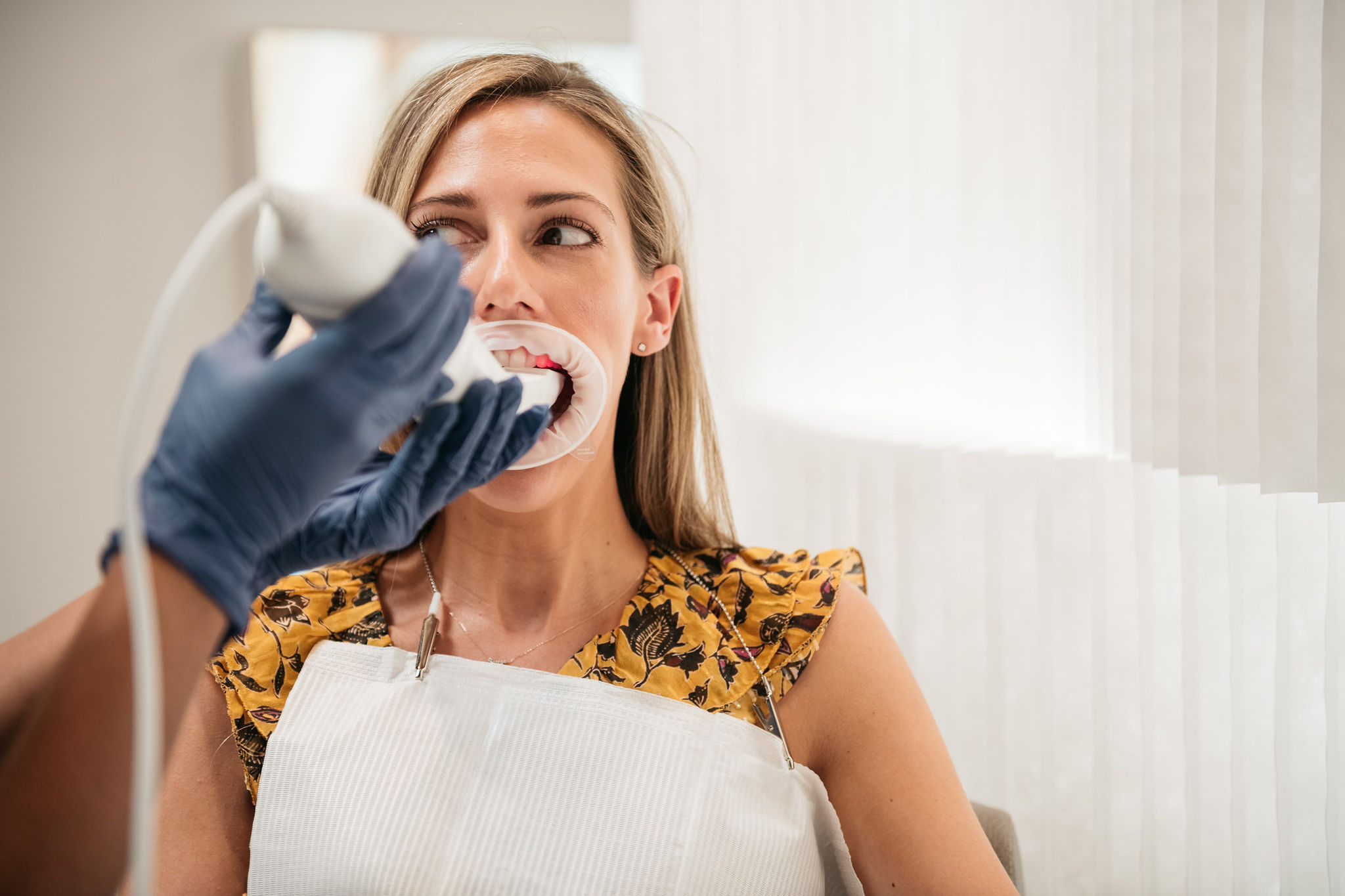 clear aligners with candid